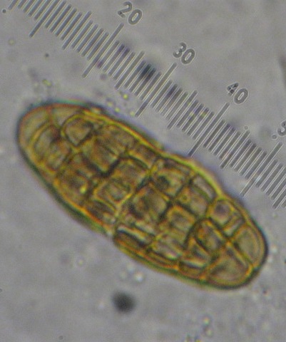 macrostoma
