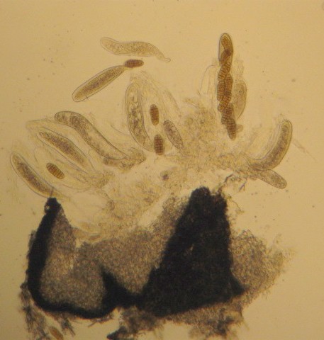 macrostoma