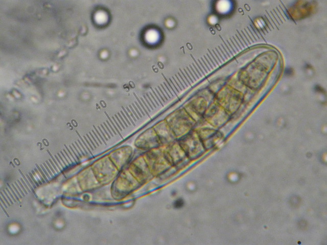 macrostoma