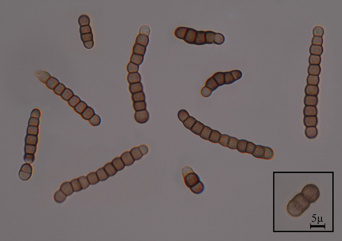 macrostoma