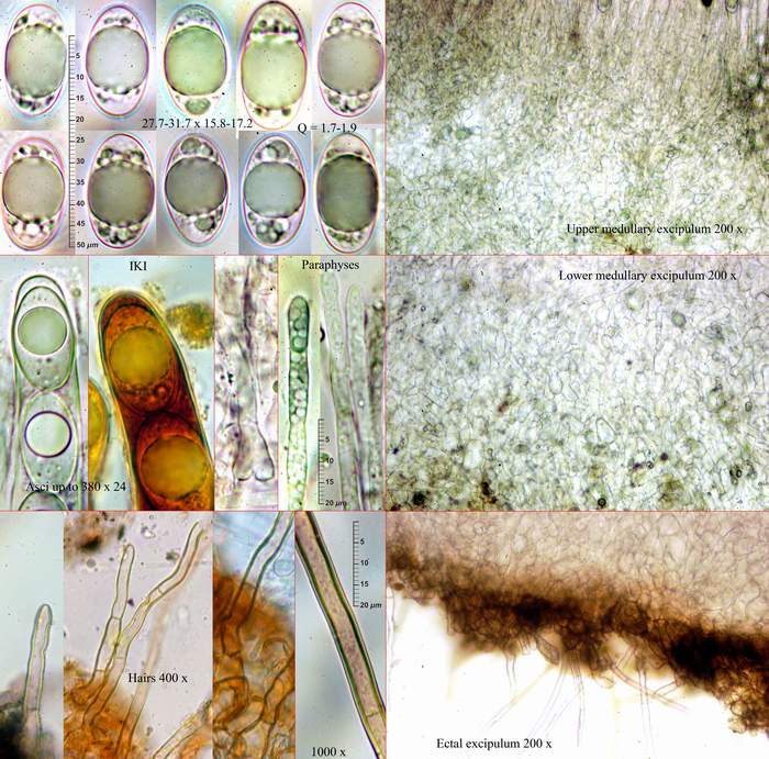macrostoma