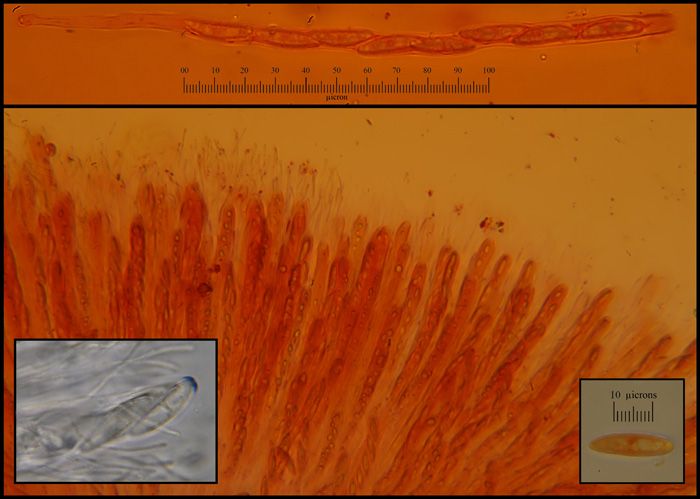 macrostoma