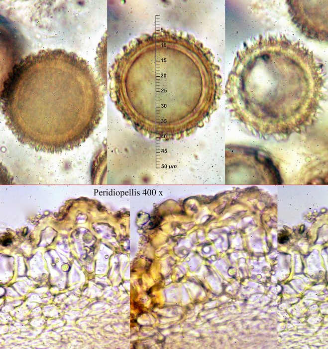 macrostoma