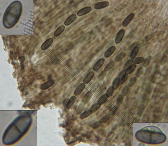 macrostoma