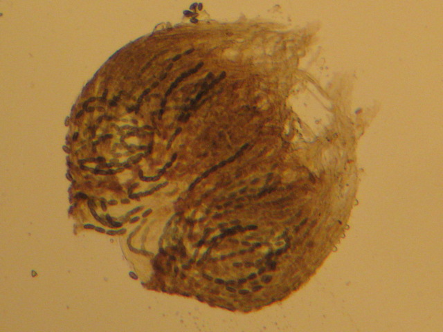 macrostoma