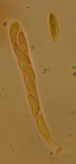 macrostoma