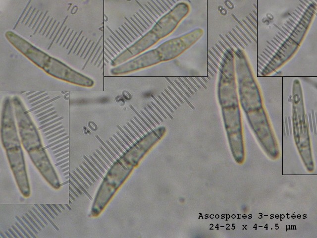 macrostoma