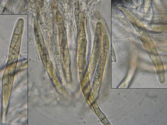 macrostoma