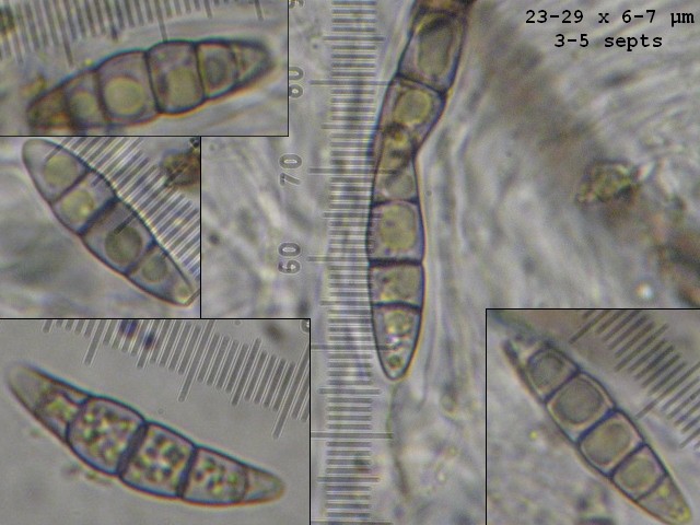 macrostoma