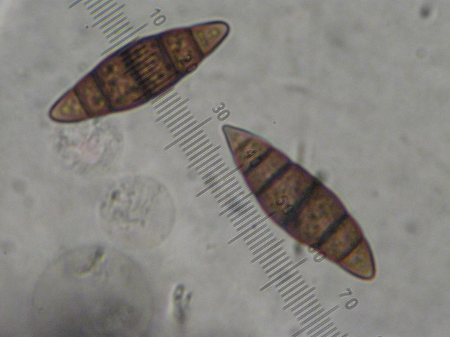 macrostoma