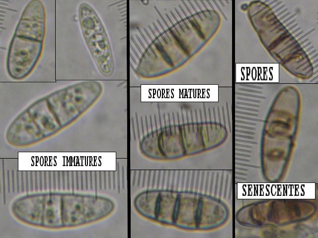 macrostoma