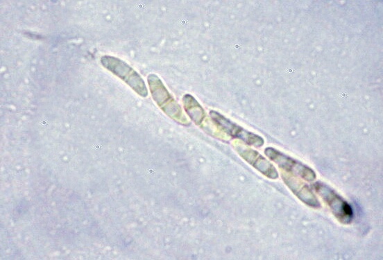 macrostoma