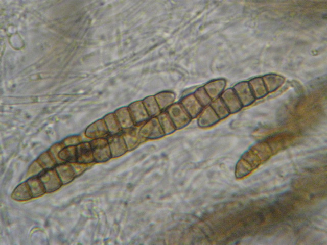 macrostoma