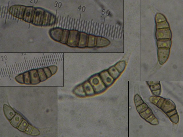 macrostoma