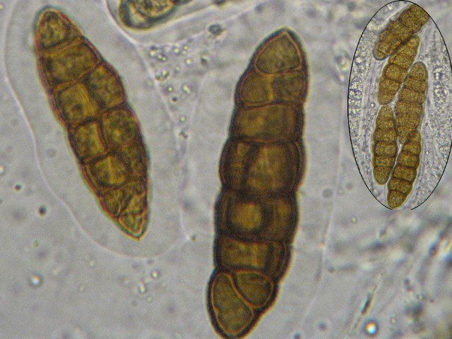 macrostoma