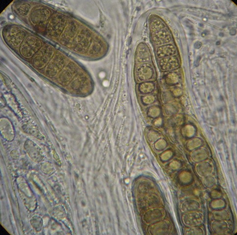 macrostoma