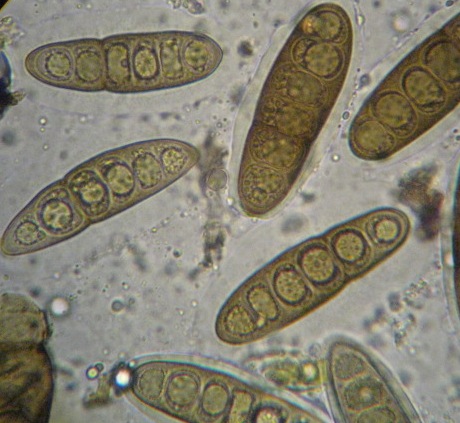 macrostoma