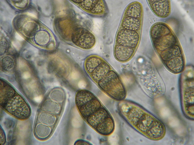 macrostoma