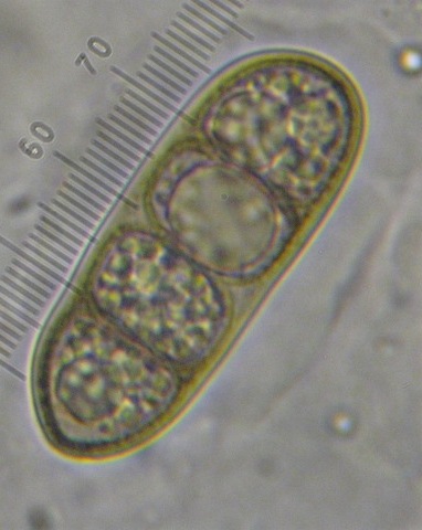 macrostoma