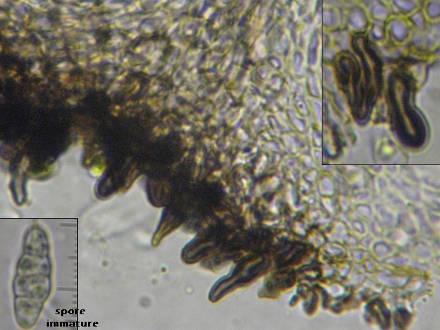 macrostoma