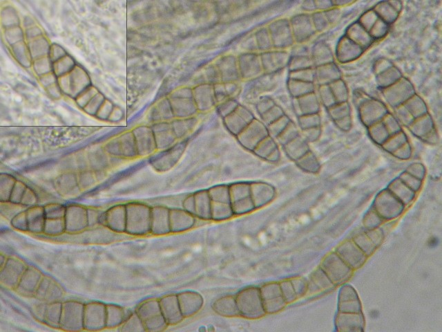 macrostoma