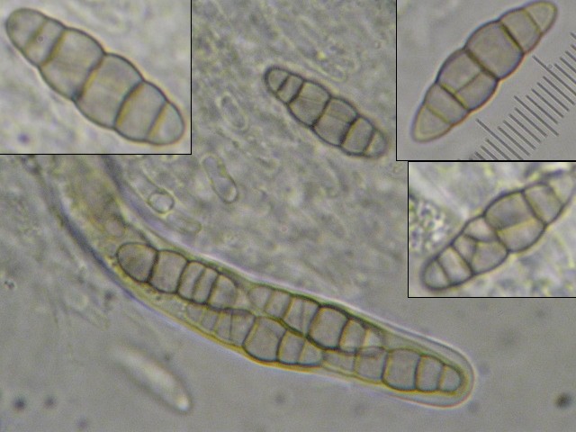 macrostoma
