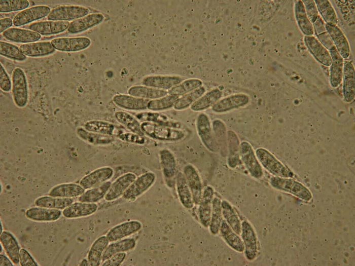 macrostoma