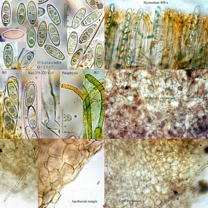 macrostoma