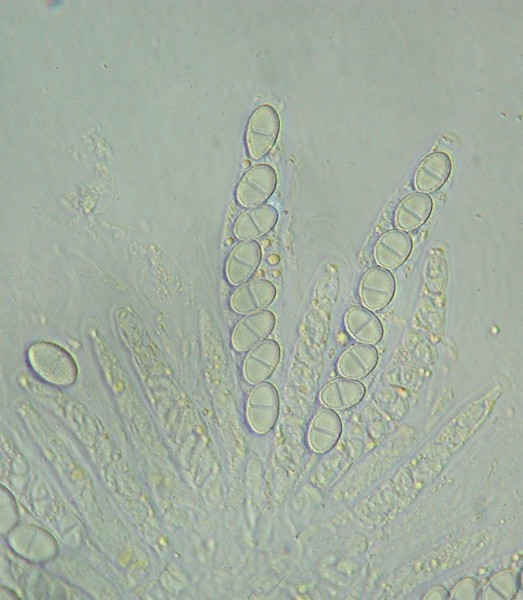 macrostoma