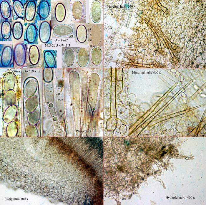 macrostoma