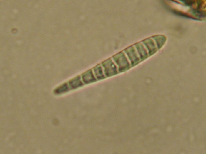 macrostoma