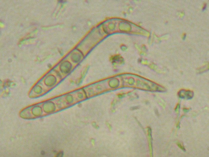 macrostoma