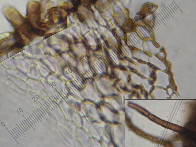 macrostoma