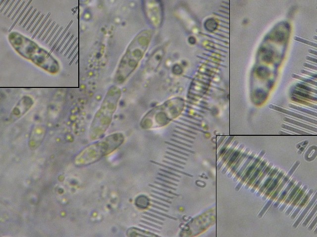macrostoma