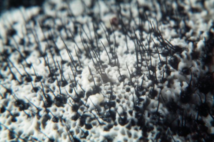 macrostoma