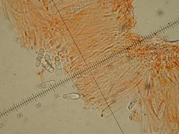 macrostoma
