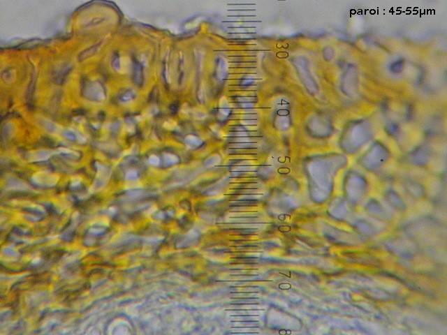 macrostoma