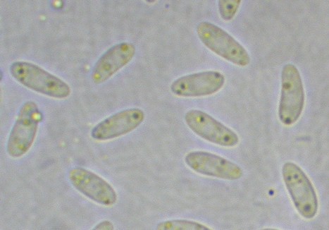 macrostoma