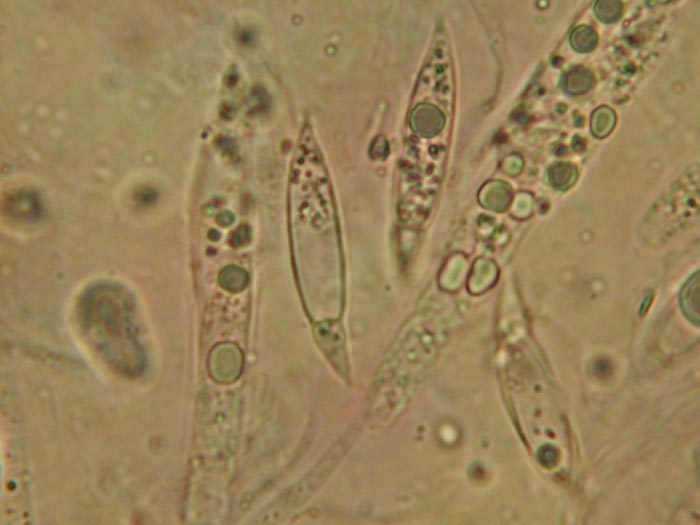 macrostoma