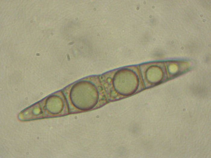 macrostoma
