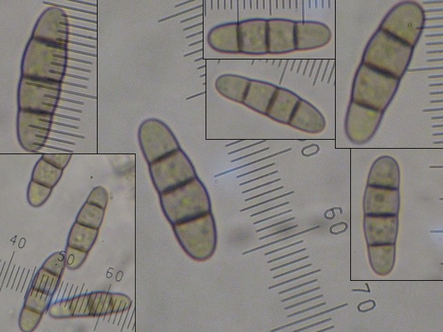 macrostoma