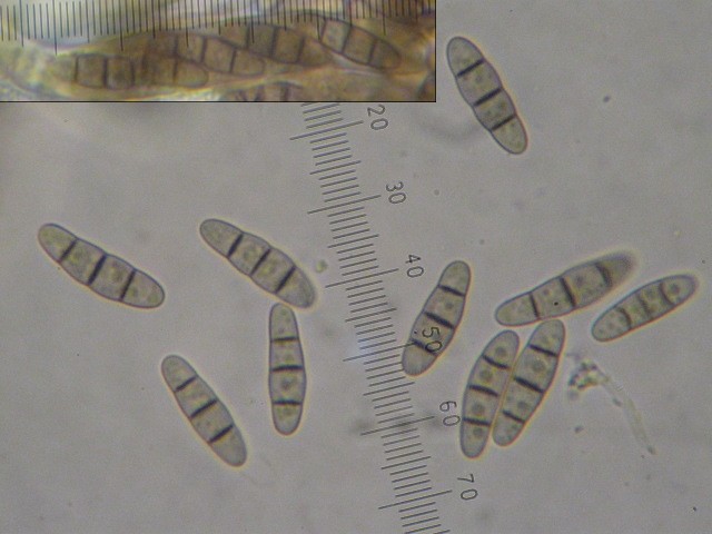 macrostoma