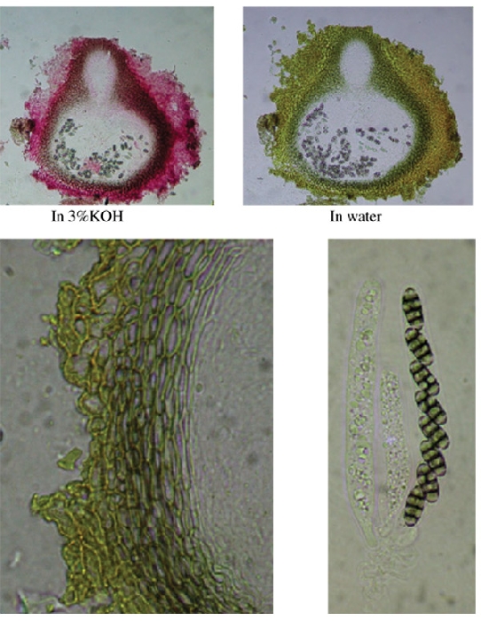 macrostoma