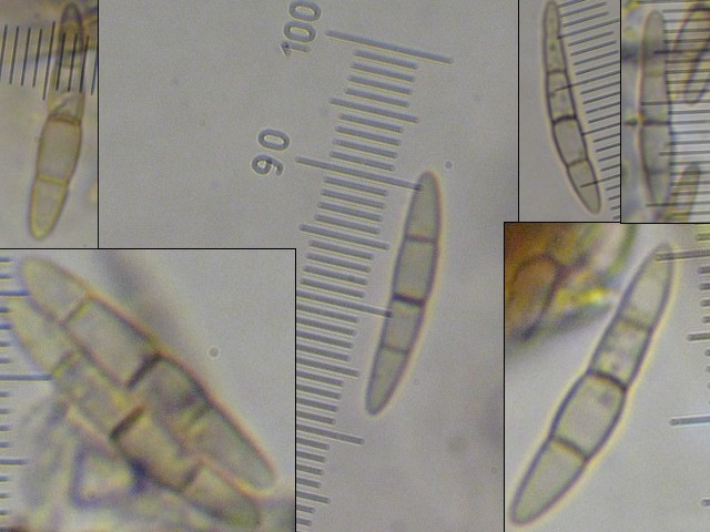 macrostoma