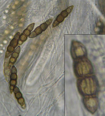 macrostoma