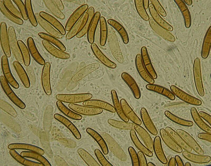 macrostoma