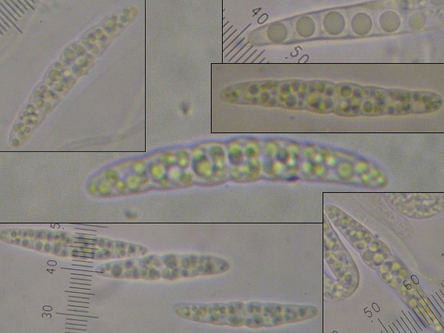 macrostoma