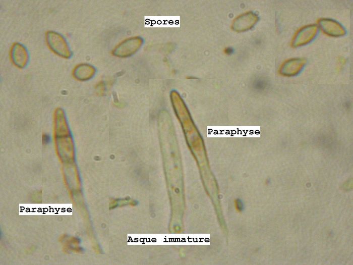 macrostoma