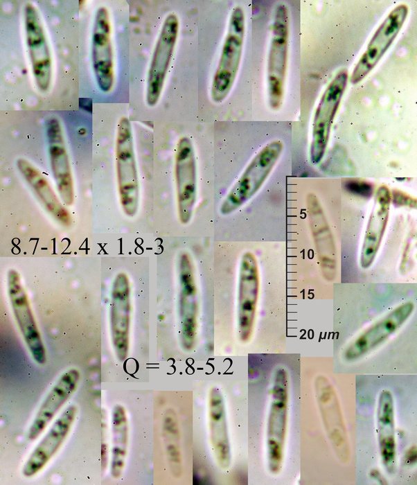 macrostoma