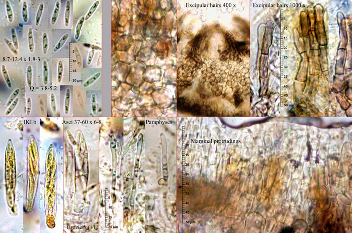 macrostoma